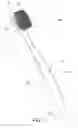 Fig. 02 - Bristle and toothbrush incorporating the same