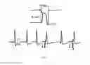 Fig. 04 - PACING SIGNAL PROCESSING METHOD, SYSTEM AND ELECTROCARDIOGRAM MONITOR