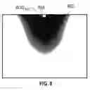 Fig. 09 - 3D-beam modulation filter for equalizing dose and image quality in breast CT