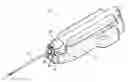 Fig. 01 - Biopsy device with automatic biopsy parameter adjustment