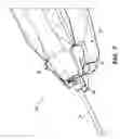 Fig. 08 - Biopsy device with automatic biopsy parameter adjustment