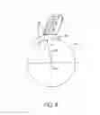 Fig. 07 - Tibial plateau leveling osteotomy plate