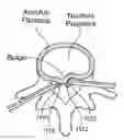 Fig. 01 - Treatment of spinal tissue
