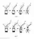 Fig. 04 - Device for the implantation and fixation of prosthetic valves