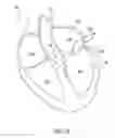 Fig. 02 - Helical coil mitral valve annuloplasty systems and methods