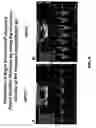 Fig. 07 - Method of treating a vasculopathy in a human subject