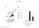 Fig. 13 - Method for determining presence or absence of suffering from malignant lymphoma or leukemia, and agent for treatment and/or prevention of leukemia