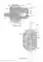 Fig. 07 - MEDICAL ARTICLE SECUREMENT SYSTEM COMPRISING A FLAP HAVING MATING SURFACES OF A MECHANICAL FASTENER ON OPPOSING MAJOR SURFACES