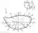 Fig. 01 - Variable thickness face plate for a golf club head