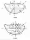Fig. 06 - Variable thickness face plate for a golf club head