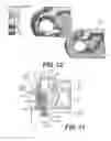 Fig. 09 - Track shoe geometry for a track chain