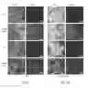 Fig. 10 - Antibacterial coating or surface comprising vertical, standing angstrom scale flakes