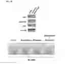 Fig. 07 - Agents and methods for treating and preventing seborrheic keratosis
