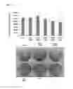 Fig. 09 - Agents and methods for treating and preventing seborrheic keratosis