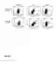 Fig. 03 - METHODS FOR PREPARING CELLS FOR ADOPTIVE T CELL THERAPY