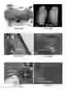 Fig. 41 - INDUCED PLURIPOTENT STEM CELLS