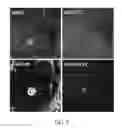 Fig. 09 - Compositions and methods for enhanced gene expression in cone cells