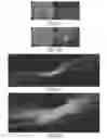 Fig. 10 - Compositions and methods for enhanced gene expression in cone cells
