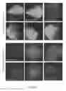 Fig. 12 - Compositions and methods for enhanced gene expression in cone cells