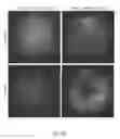 Fig. 13 - Compositions and methods for enhanced gene expression in cone cells
