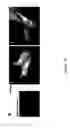 Fig. 03 - Engineered respiratory syncytial viruses with control of cell-to-cell virus transmission for enhanced safety of live virus vaccines