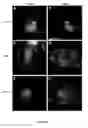 Fig. 08 - Engineered respiratory syncytial viruses with control of cell-to-cell virus transmission for enhanced safety of live virus vaccines