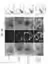 Fig. 27 - DIRECTED DIFFERENTIATION OF PLURIPOTENT STEM CELLS BY BACTERIAL INJECTION OF TALEN PROTEINS