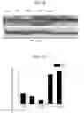 Fig. 06 - INTRATHECAL DELIVERY OF NUCLEIC ACID SEQUENCES ENCODING ABCD1 FOR TREATMENT OF ADRENOMYELONEUROPATHY