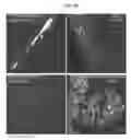 Fig. 09 - INTRATHECAL DELIVERY OF NUCLEIC ACID SEQUENCES ENCODING ABCD1 FOR TREATMENT OF ADRENOMYELONEUROPATHY