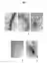 Fig. 14 - DISEASE RESISTANT PLANTS