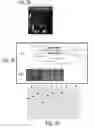 Fig. 22 - LABYRINTHULID MICROORGANISM CAPABLE OF PRODUCING MICROBIAL OIL, MICROBIAL OIL, METHODS FOR PRODUCING SAID MICROORGANISM AND FOR PRODUCING SAID MICROBIAL OIL, AND USES OF SAID MICROORGANISM AND SAID MICROBIAL OIL