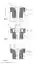 Fig. 03 - Thread draw-off nozzle having notches extending radially to the nozzle bore
