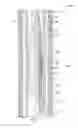 Fig. 03 - Galvanic degradable downhole tools comprising doped aluminum alloys