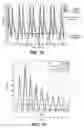 Fig. 15 - Engine torque smoothing