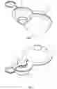 Fig. 02 - Inflating device