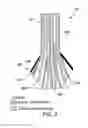 Fig. 04 - COMPOSITE AIRFOIL WITH METAL STRENGTH