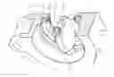 Fig. 01 - Flow control valve