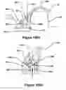 Fig. 41 - Goal securement system and method