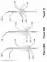 Fig. 47 - Goal securement system and method