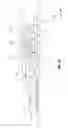 Fig. 05 - Retainer ring for a light fixture