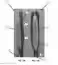 Fig. 02 - ENDOENTERIC BALLOON COIL