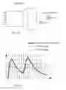 Fig. 03 - Method and system for real-time processing of pulse pile-up event