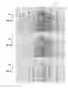 Fig. 09 - Refraction-based surface-consistent amplitude compensation and deconvolution
