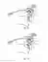 Fig. 10 - Flip-up eyeshield assembly