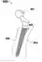 Fig. 01 - MEDICAL DEVICE FOR BONE IMPLANT AND METHOD FOR PRODUCING SUCH A DEVICE