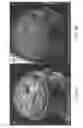 Fig. 07 - Capacitor with electrodes made of an interconnected corrugated carbon-based network