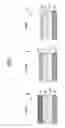 Fig. 04 - Etching method