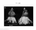 Fig. 06 - Methods and systems for growing plants using silicate-based substrates, cultivation of enhanced photosynthetic productivity and photosafening by utilization of exogenous glycopyranosides for endogenous glycopyranosyl-protein derivatives, and formulations, process and systems for the same