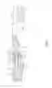 Fig. 06 - TOOTHBRUSH WITH A REPLACEABLE FUNCTION PART