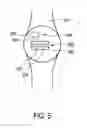 Fig. 06 - PHOTOPLETHYSMOGRAPHY DEVICE
